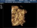 3D, in der 30 SSW 