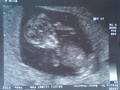 12SSW ... und das mit dem Mittelfinger, kann es nur vom Papa haben =) 