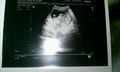 Erste Schwangerschaft von michaela1989