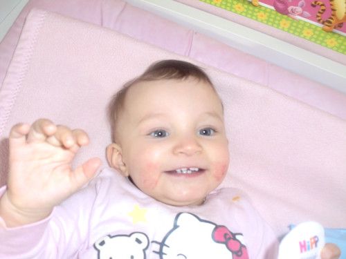 Endlich kann ich richtig Beißen :-)