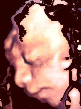 FINNIAN: ganz der Vater - nur die Nase ist von Mama...