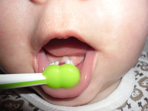 Meine erste Zähnchen