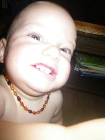 du willst meine zähne sehen????daaaa