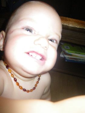 du willst meine zähne sehen????daaaa