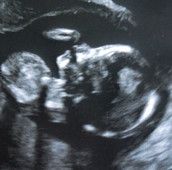 Profilfoto  Eichhoernchen87