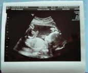 Profilfoto  Goldwaegele