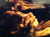 Profilfoto  ProjektPuppe14