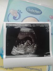 Profilfoto  Jacky123