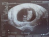 Profilfoto  mama2011