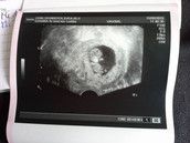 Profilfoto  Honigtopf