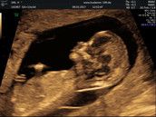 Profilfoto  Wonder2017