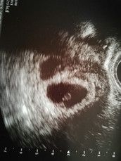 Profilfoto  Jannchen87