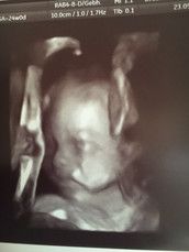 Profilfoto  wackel2043