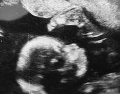 Profilfoto  oktoberbauchzwerg