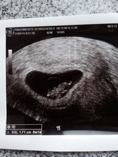 Profilfoto  Elli1978