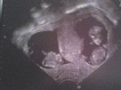 Profilfoto  SayaPlusZwei