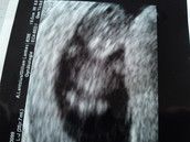 Profilfoto  Lailanie