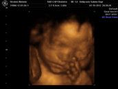 Profilfoto  meli1988l