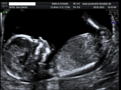 Profilfoto  kati187874