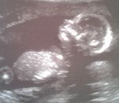 Profilfoto  Schneeschuhhase