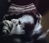 Profilfoto  LeniBaby