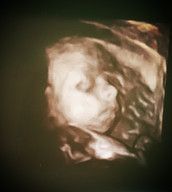 Profilfoto  Bella2016