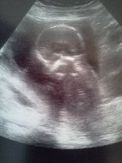 Profilfoto  Tini-chen