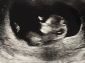 Profilfoto  Mrs-Balu