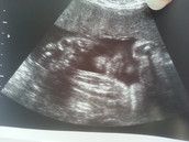 Profilfoto  Franky90