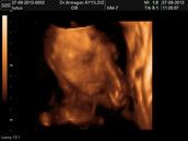 Profilfoto  baby_wunsch