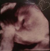 Profilfoto  Monique1994