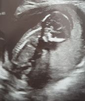 Profilfoto  Hermine32