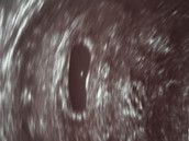 Profilfoto  XyTanni85