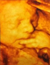 Profilfoto  Charlotte_173