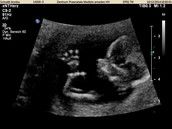 Profilfoto  Annika1272