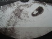 Profilfoto  _RockStarBaby_