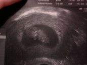 Profilfoto  chrischy2011