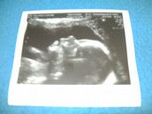 Profilfoto  frechdacks23