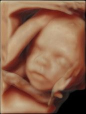 Profilfoto  Pfannkuchen