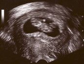 Profilfoto  Butterfly1991