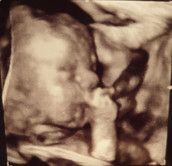 Profilfoto  Wunschbohne2019