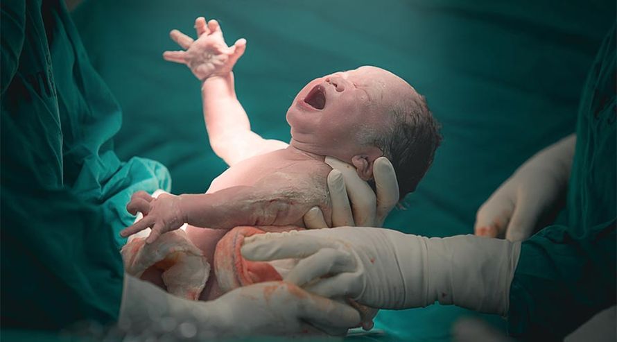 Kaiserschnitt nach Kaiserschnittnarbe: Pflege